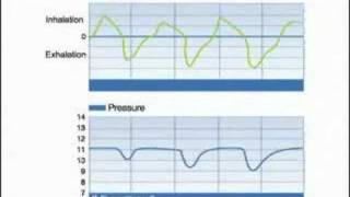 Introduction To Respironics CPAP CFlex Part 3 [upl. by Eugenides]