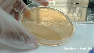 Oxidase Test for Pseudomonas [upl. by Ycnuahc]