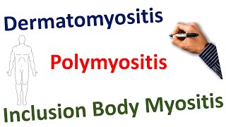 Dermatomyositis Polymyositis Inclusion Body Myositis STEP NCLEX COMLEX [upl. by Thagard]