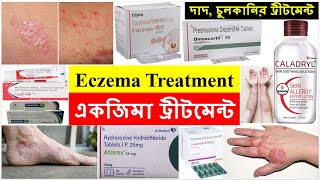 একজিমা ট্রীটমেন্ট Eczema Treatment Bong Pharma [upl. by Mairhpe]