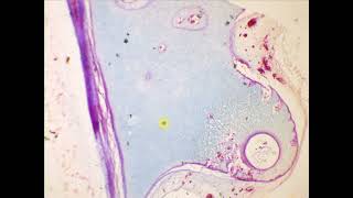 Hyaline cartilage Hyaline cartilage Special stain [upl. by Bryner]