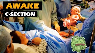 Miracle of life  Awake CSection [upl. by Friedlander]