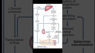 Pathophysiology Of Ascites  Portal Hypertension medical [upl. by Macintosh]