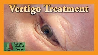 Vertigo Treatment  Auburn Medical Group [upl. by Adelia541]