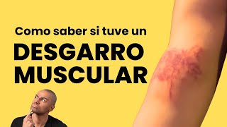 ¿Cómo saber si tengo un DESGARRO MUSCULAR💪💥 [upl. by Mattie]