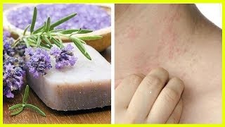 Special Homemade Soap for Sensitive Skin and Dermatitis [upl. by Bandler]