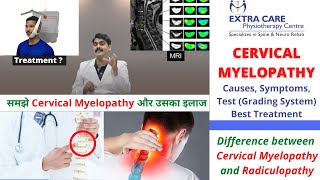 Cervical Myelopathy Physiotherapy Treatment  Causes Symptoms Test amp Grading  NO SURGERY NEEDED [upl. by Suiradal]