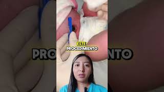 ⚠¡NO MAS COMPLICACIONES NEONATALES 👶 [upl. by Aseyt]