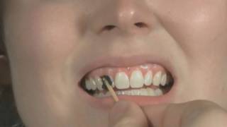 Tooth Wax Tutorial [upl. by Uaerraj]