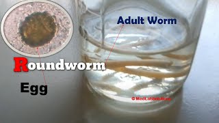 Adult Roundworm and its Egg Demonstration [upl. by Nauquf]