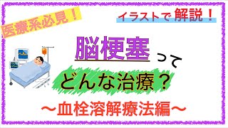 教科書をわかりやすく！「脳梗塞の治療とは？〜血栓溶解療法（rtpa療法）をイラストで解説〜」 [upl. by Mart160]