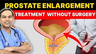 Prostatic Artery Embolization PAE For Prostate Enlargement Treatment  Ideal Candidates For PAE [upl. by Hoagland]