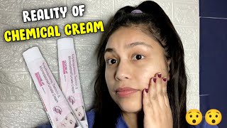 Elosone HT cream review  Best cream for PigmentationDarkspottanningmelasma Elosone HT review [upl. by Spring]