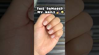 Nail extensions ki galti 😭😭nails nailsextension viralvideo shortsfeed viralshort trending [upl. by Farrington]