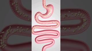 How to Detox Your Intestines [upl. by Auqeenwahs]