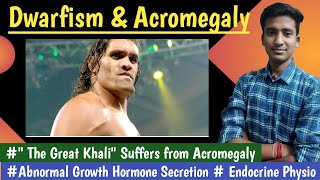 Acromegaly amp Dwarfism amp Gigantism  Growth HormoneEndocrine Physiology  in hindi Ashish [upl. by Neau]