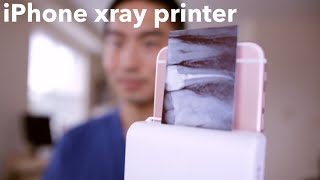 iPHONE XRAY PRINTER for DENTISTS [upl. by Oranneg]