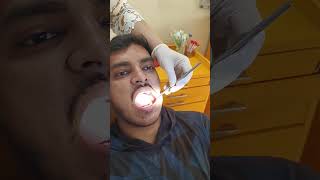 Dentist daat kaise fix karte hai [upl. by Eramat]