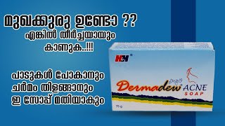 മുഖക്കുരു പാടുകൾ പോകാൻ ഒരു സോപ്പ്  Derma Dew Acne Soap Honest Review [upl. by Sawyere]