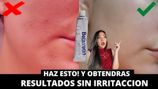 TRETINOINA RETINOL Y ADAPALENO SIN IRRITACION Las Mejor Crema Contra MANCHAS y ARRUGAS Kelly Perez [upl. by Griseldis]