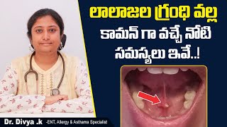 లాలాజల గ్రంధి సమస్యలు  What is Salivary Gland  Common Salivary Gland Problems  Sankhya Hospitals [upl. by Bonina]