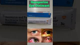 Neosporine  Neosporine antibiotic ointment  Medicine for eye infections shorts [upl. by Nnahoj]