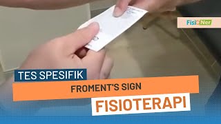 Froments sign [upl. by Dnomayd236]