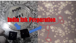 India Ink Preparation from culture of Cryptococcus neoformans [upl. by Lacym770]