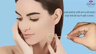 WARTOSIN WART REMOVER HINDI [upl. by Koressa]