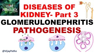 RENAL PATHOLOGY Part 3  Glomerulonephritis PATHOGENESIS [upl. by Eillim386]