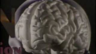 Aggression Violence and the Brain [upl. by Alleunam]