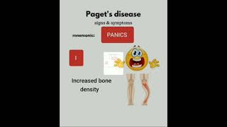 🐬 PAGETS disease MNEMONIC 🦈 [upl. by Terry722]