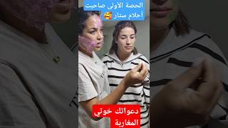 الحصة الأولى عند حنان إزالةالكلف اكسبلور ازالةالتجاعيد تيكتوك ترند tattoo [upl. by Terrel228]