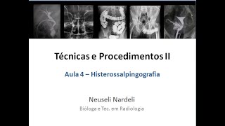 Aula 4  Técnicas e Procedimentos II  Histerossalpingografia [upl. by Emya]