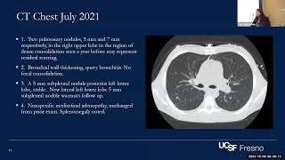 Central Valley Chronicles Challenging Coccidiomycosis Cases in PWH [upl. by Errick]