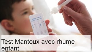 Peuton faire le test de Mantoux en cas de rhume et toux  Impact sur les résultats [upl. by Anierdna]