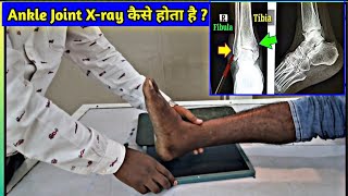 Ankle Joint Digital Xray कैसे होता है  Step by Step  Ankle Joint Xray udayxray [upl. by Chet18]