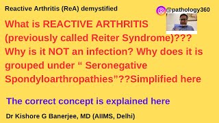 Reactive Arthritis ReAPreviously Reiter Syndrome DEMYSTIFIED ReactiveArthritis Reiter md [upl. by Lachance]