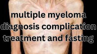 Understanding Multiple Myeloma Diagnosis Treatment and Fasting [upl. by Zetneuq989]