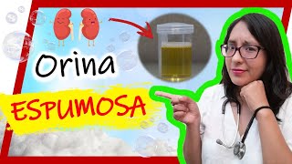 🆘 ORINA ESPUMOSA 💥 ¿Qué Significa ¿ORINA con ESPUMA es bueno o malo💊 [upl. by Artie]