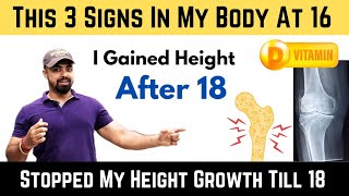 What Will Happen To Your HEIGHT GROWTH If Your Body Shows This 3 Signs Of VITAMIN D Deficiency [upl. by Anselmi761]