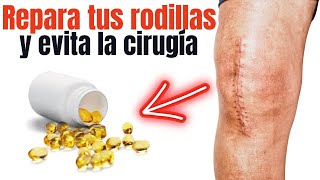 La VITAMINA 1 para RODILLAS ENFERMAS Prevenir cirugía inflamación dolor [upl. by Figueroa]