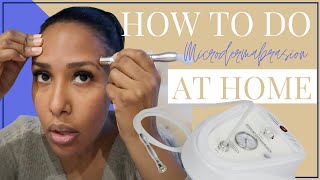 How I Do My Microdermabrasion Facial At Home  Great For Dark Skin  Hyperpigmentation Nicole Davies [upl. by Glaab]