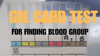 BLOOD GROUPING By quotGEL CARDquot methodmicrobiology pathology blood banking [upl. by Ware879]