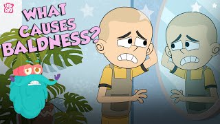 What Causes Baldness  Causes Of Hair Loss  The Dr Binocs Show  Peekaboo Kidz [upl. by Harrat]