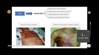 INSPECCIÓN II Y PALPACIÓN I  SEMIOLOGÍA DEL SISTEMA RESPIRATORIO [upl. by Sievert760]