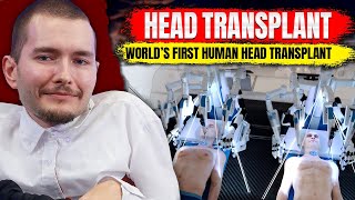 What Happened to the First Human Head Transplant​  Shadow Stories [upl. by Sabanrab581]