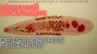 Кошачий сосальщик Opisthorchis felineus  Описторхоз Жизненный цикл Диагностика Профилактика [upl. by Tomlinson563]