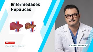 Enfermedades Hepaticas  Diagnostico Signos y Sintomas mas frecuentes [upl. by Llertnauq686]