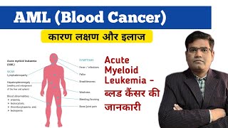 Acute Myeloid Leukemia AML Cause Symptoms Tests and Treatment Explained  Blood Cancer [upl. by Granlund]